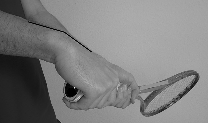 Belastungsprofil des Handgelenks bei beidhändiger Rückhand kurz vor dem Treffpunkt des Balls